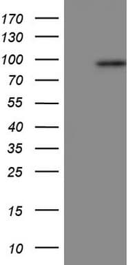 IHC-plus™ POSTN / Periostin Antibody (aa538-781, clone 2B2)