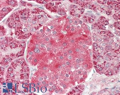 IHC-plus™ Polyclonal Rabbit anti-Human CLINT1 Antibody (aa150-200, IHC)