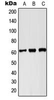 PKLR Antibody (C-Terminus)