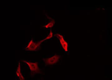 RICK / RIP2 Antibody (phospho-Ser176)