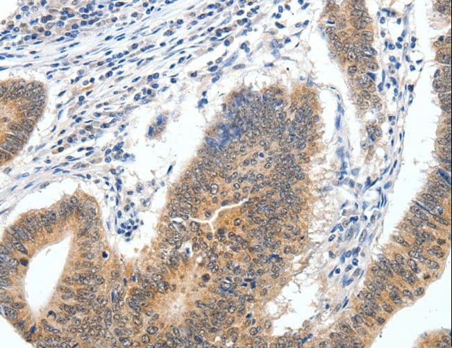 ECE2 Antibody