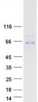 Human ANGPTL3 Protein (Recombinant Myc-DDK (Flag))
