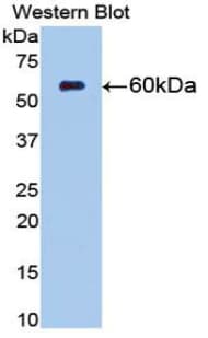 NT5E / eNT / CD73 Antibody (aa29-550)