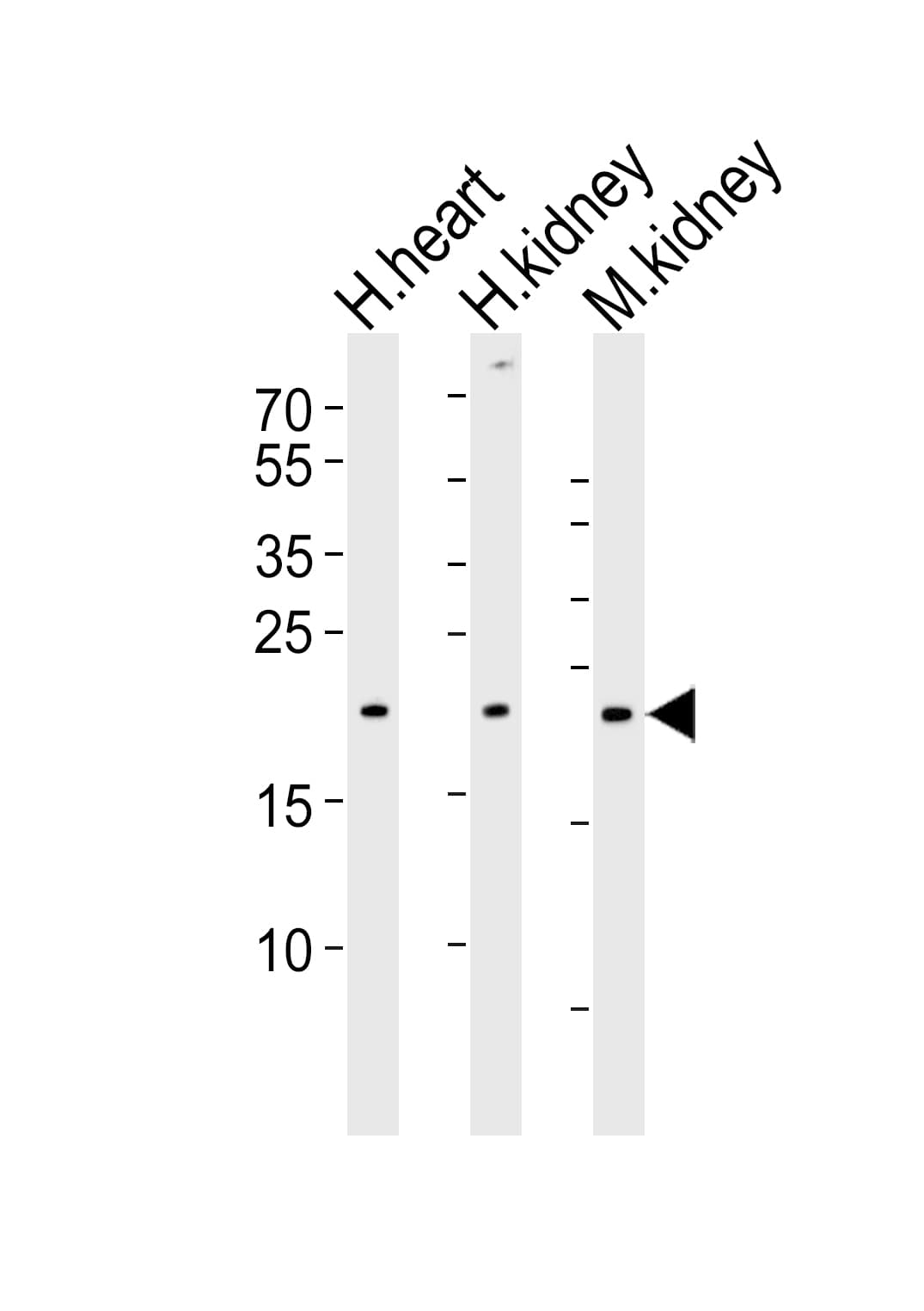 CYS1 Antibody (aa142-177)