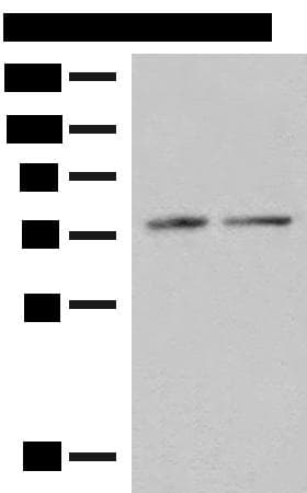 Polyclonal Rabbit anti-Human PDIA4 / ERP72 Antibody (IHC, WB)