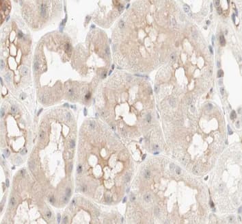 Polyclonal Rabbit anti-Human PCK1 Antibody (IHC, WB)