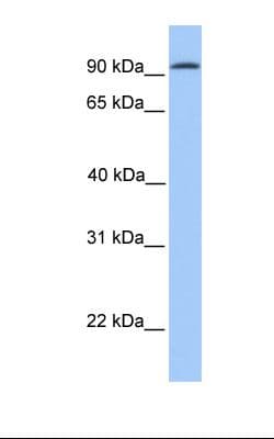 Polyclonal Rabbit anti-Human CDH16 / Cadherin 16 Antibody (aa151-200, IHC, WB)