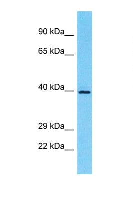 OR5M10 Antibody (aa155-204)