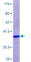 Human TRAPPC1 / MUM2 Protein (Recombinant GST)