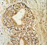 ATP11C Antibody (aa589-616)
