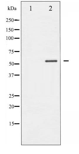Polyclonal Rabbit anti-Human MEF2A / MEF2 Antibody (phospho-Thr319, IHC, WB)