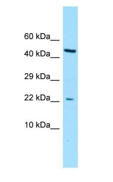 CGGBP1 Antibody (aa38-87)