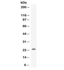 Polyclonal Rabbit anti-Human CNTF Antibody (WB)