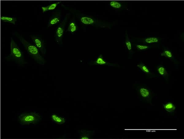 Monoclonal Mouse anti-Human GAN Antibody (clone 4G7, IF, WB)