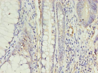Polyclonal Rabbit anti-Human APLNR/ Apelin Receptor / APJ Antibody (IHC)