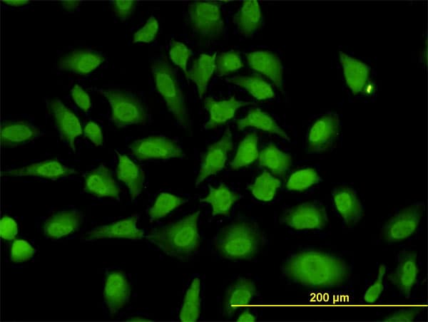 IHC-plus™ HNRNP-E2 / PCBP2 Antibody (clone 5F12)