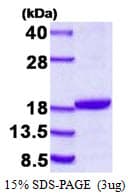 Human DSTN / Destrin Protein (Recombinant His)