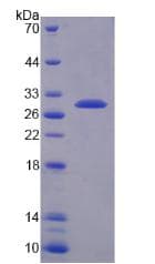 Human QDPR / DHPR Protein (Recombinant His-T7)