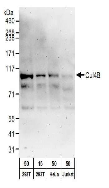 Polyclonal Rabbit anti-Human Cullin 4B / CUL4B Antibody (aa863-913, IHC, WB)