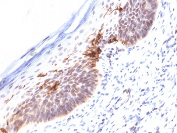 CD1A Antibody (clone SPM120)