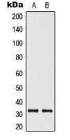 IHC-plus™ ELOVL1 Antibody (Internal)