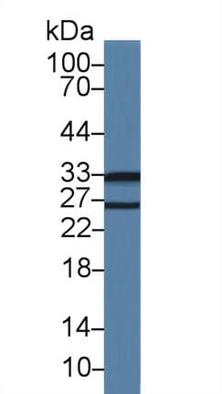 ARH / LDLRAP1 Antibody (aa1-308, APC)