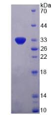 Human PDGF-BB Protein (Recombinant His-T7)