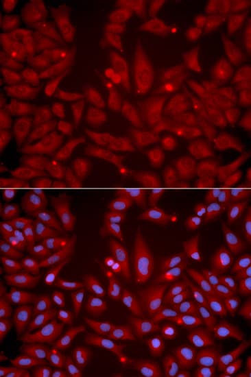 GRIK2 / GLUR6 Antibody