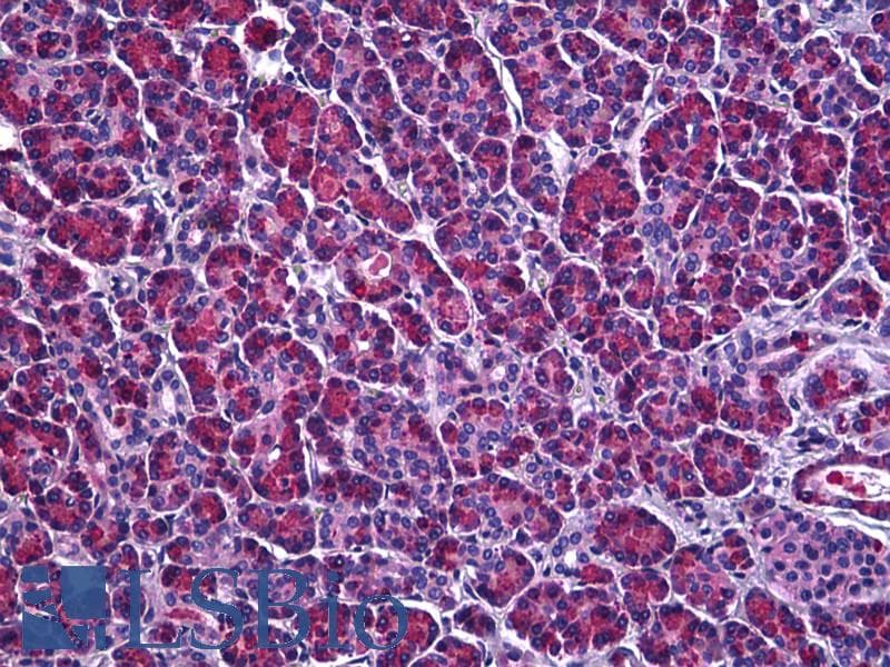 IHC-plus™ ATXN1 / SCA1 Antibody (aa742-791)