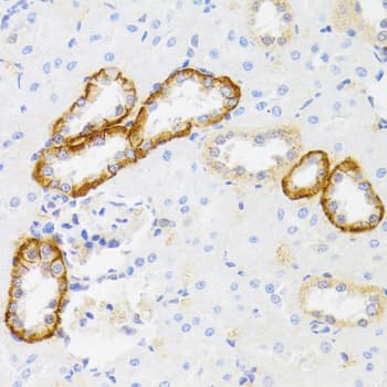 MYO5A / Myosin V Antibody
