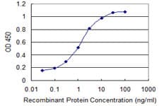 Monoclonal Mouse anti-Human Yo / CDR2 Antibody (clone 1F8, IHC, WB)