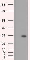 RDH11 Antibody (clone OTI1B4)