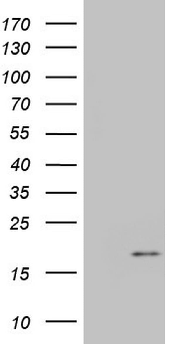 Monoclonal Mouse anti-Human IGF1 Antibody (clone OTI4B12, aa1-151, IHC, WB)