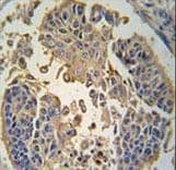 RIPK3 / RIP3 Antibody (aa489-518)