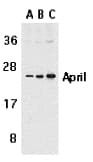 IHC-plus™ Polyclonal Rabbit anti-Human TNFSF13 / APRIL Antibody (IHC, WB)