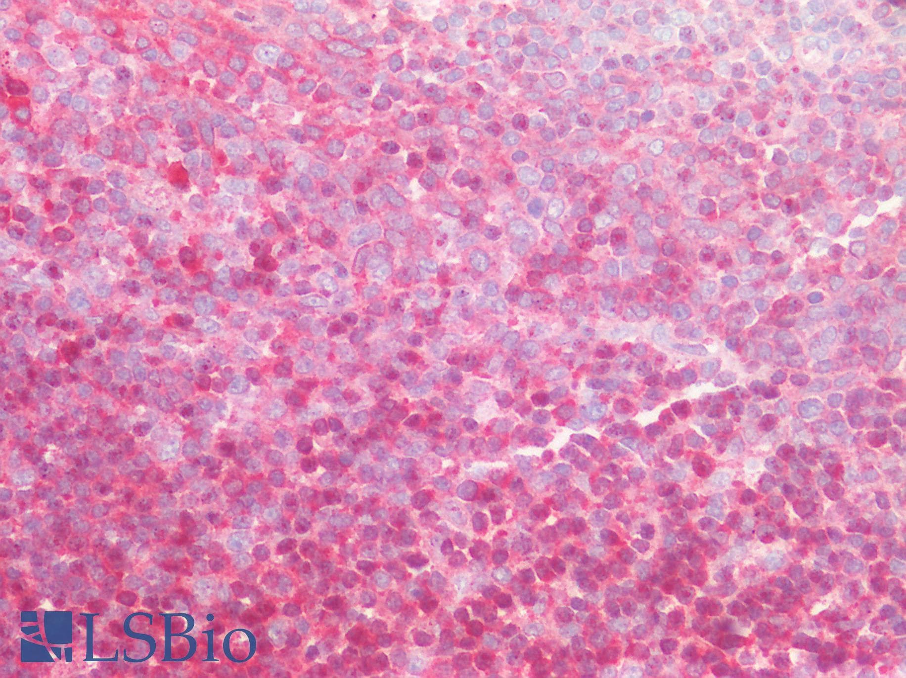DGKA Antibody