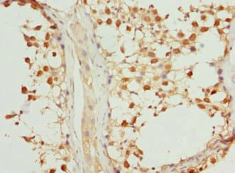 Polyclonal Rabbit anti-Human VRK1 Antibody (IHC, WB)