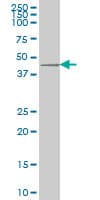 Monoclonal Mouse anti-Human DKK1 Antibody (clone 2A5, WB)