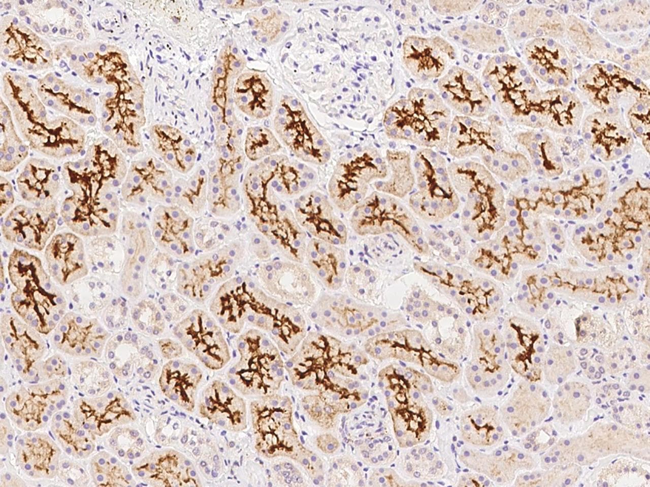 SLC34A3 / NaPi-2c Antibody