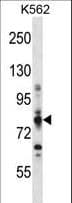 CPT1A Antibody (aa728-756)