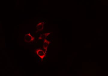 Polyclonal Rabbit anti-Human c-CBL Antibody (IHC, IF, WB)