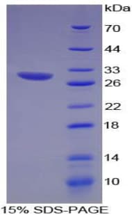 Rat CX3CL1 / Fractalkine Protein (Recombinant His)