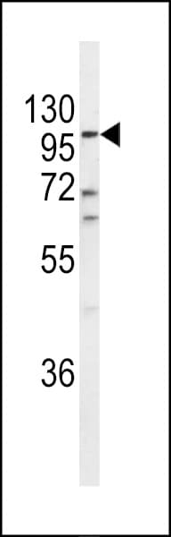 ECE-1 Antibody (aa528-556)