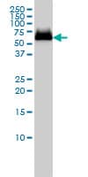 GBA / Glucosidase Beta Acid Antibody (clone 2e2)