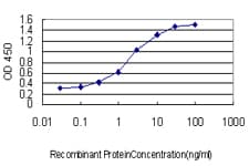 Monoclonal Mouse anti-Human STAR Antibody (clone 5F9, WB)