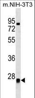 Polyclonal Rabbit anti-Human METTL7B Antibody (aa37-63, WB)