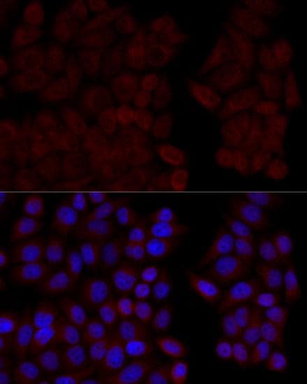 CALM1 / Calmodulin Antibody
