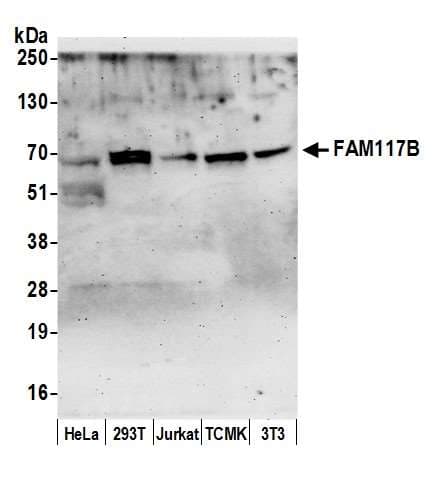 FAM117B / ALS2CR13 Antibody (aa525-575)
