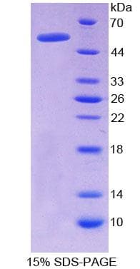 Rat NR1H4 / FXR Protein (Recombinant His-GST)