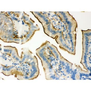 Polyclonal Rabbit anti-Human PLEC / Plectin Antibody (aa2644-2671, IHC, WB)